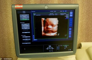 3d image of child dih