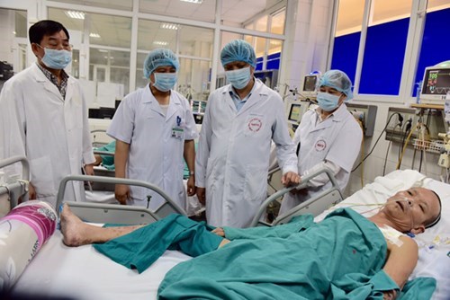 mers_zbde