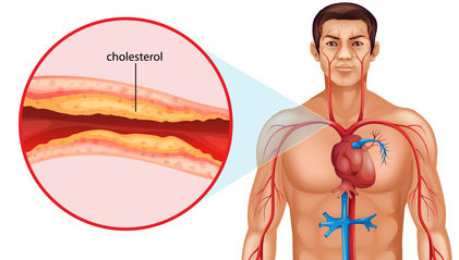 cholestrol_regulation
